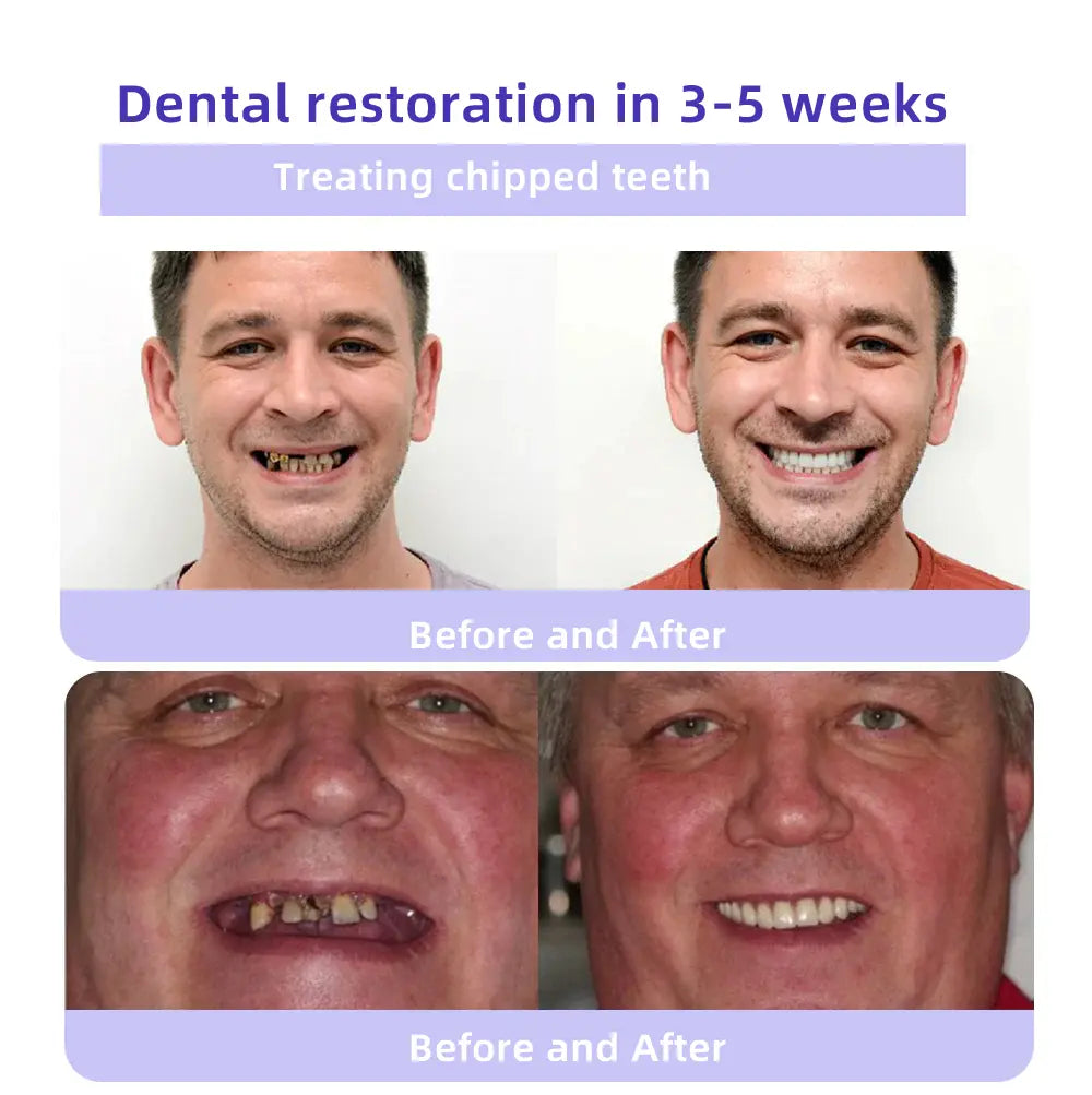 Минерален прах за възстановяване на зъби