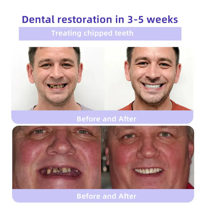 Минерален прах за възстановяване на зъби